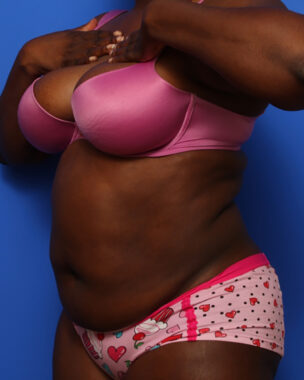 Case # 6 before photo