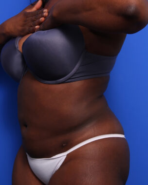 Case # 6 after photo