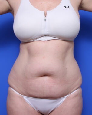 Case # 7 before photo