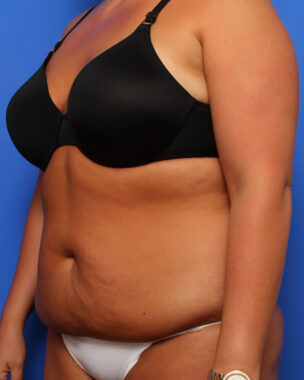 Case # 8 before photo