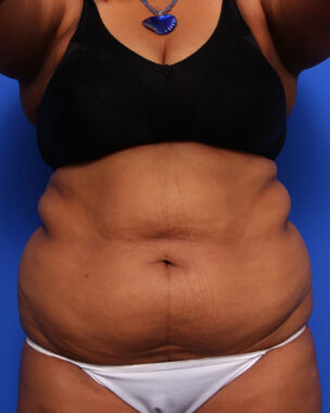 Case # 9 before photo