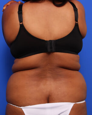 Case # 9 before photo