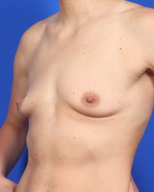 Case # 21 before photo