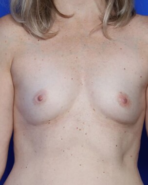 Case # 22 before photo