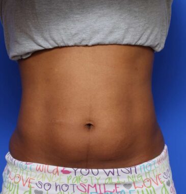 Case # 1 after photo