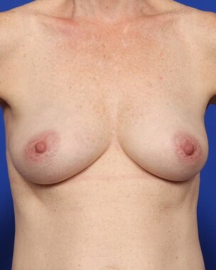 Case # 26 after photo