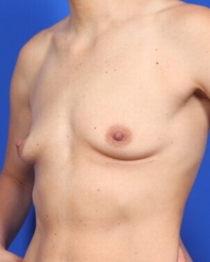 Case # 27 before photo