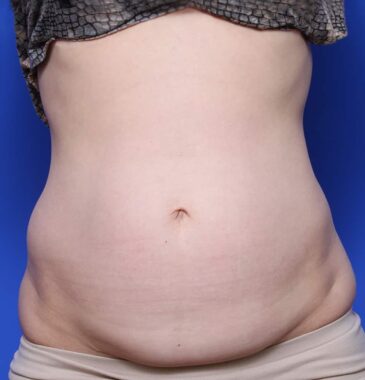 Case # 5 before photo