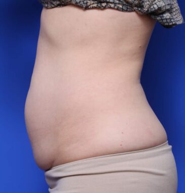 Case # 5 before photo