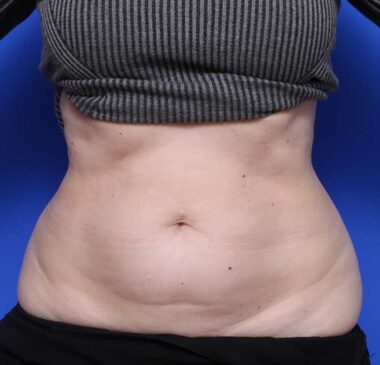 Case # 6 after photo