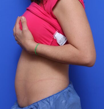 Case # 8 before photo