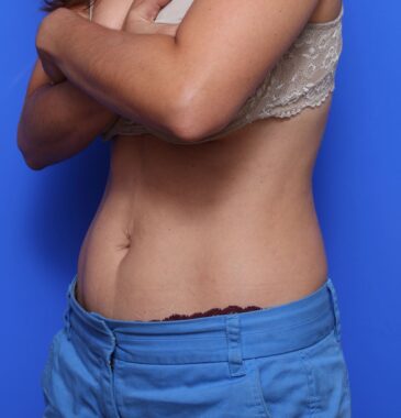 Case # 8 after photo