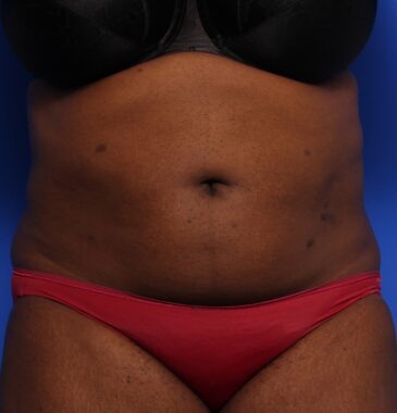 Case # 11 before photo