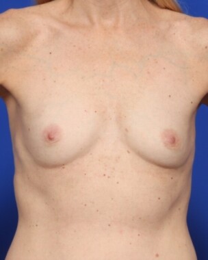 Case # 28 before photo