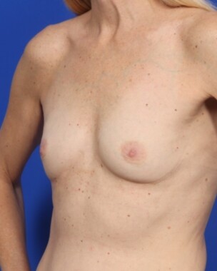 Case # 28 before photo