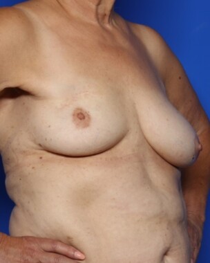 Case # 30 before photo