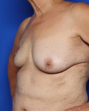 Case # 30 before photo