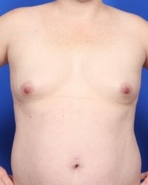 Case # 31 before photo