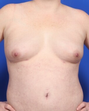 Case # 31 after photo