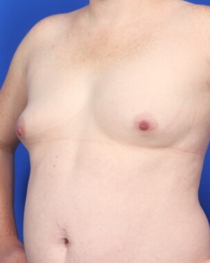 Case # 31 before photo