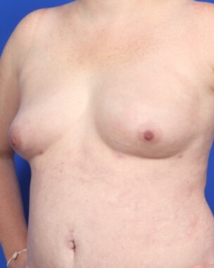 Case # 31 after photo