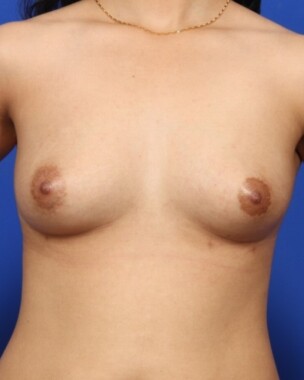 Case # 34 after photo