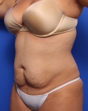 Case # 32 before photo