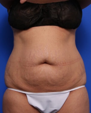 Case # 34 before photo