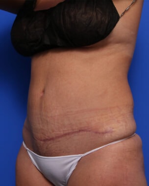 Case # 34 after photo