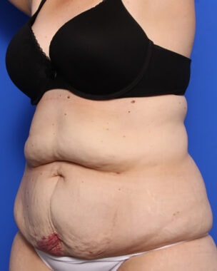 Case # 36 before photo