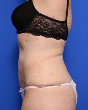 Case # 36 after photo