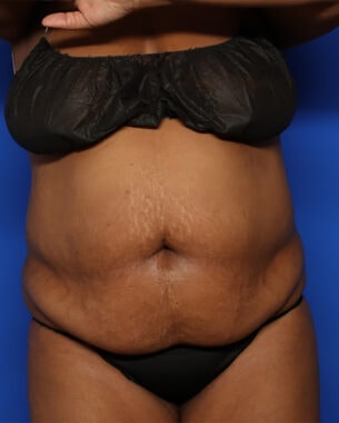 Case # 37 before photo