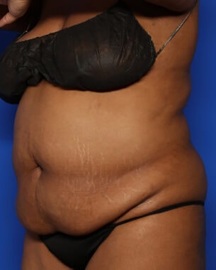 Case # 37 before photo