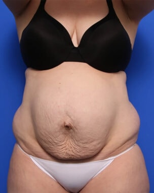 Case # 3 before photo