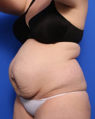 Case # 3 before photo