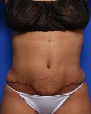 Case # 38 after photo