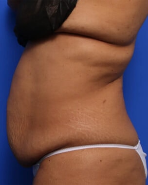 Case # 38 before photo