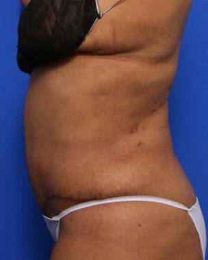 Case # 38 after photo