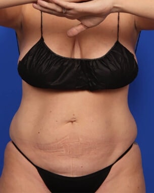 Case # 39 before photo