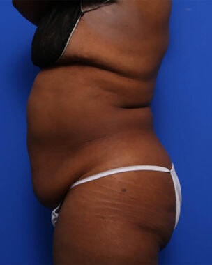 Case # 41 before photo