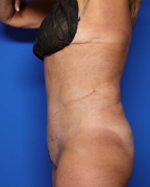 Case # 19 after photo