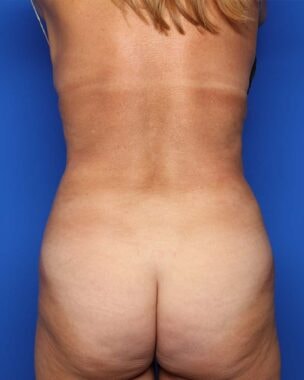 Case # 19 after photo