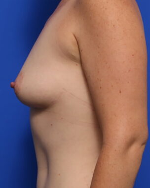 Case # 9 after photo