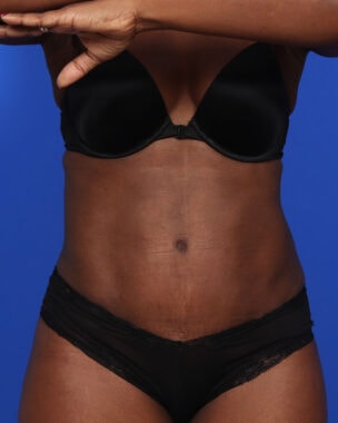 Case # 15 after photo