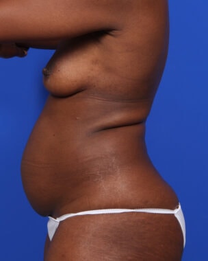 Case # 15 before photo