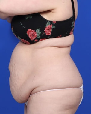 Case # 14 before photo