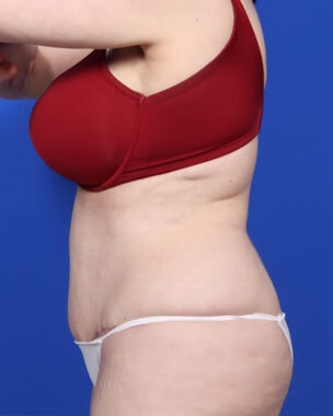 Case # 14 after photo