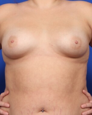 Case # 35 before photo