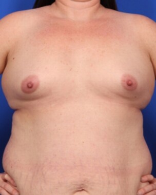 Case # 39 before photo