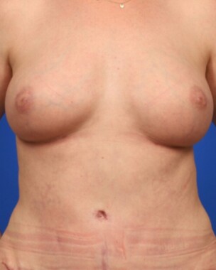 Case # 40 after photo